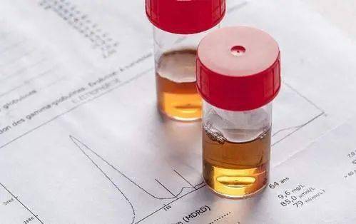 尿液|箭头高高低低看不懂？不懵圈、不求人，一篇教你看懂尿常规！