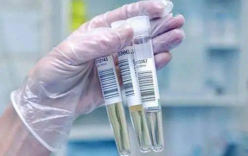 尿液|箭头高高低低看不懂？不懵圈、不求人，一篇教你看懂尿常规！