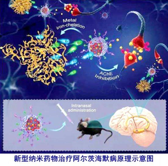 天津大学探索新型纳米药物02有望成为阿尔茨海默病患者福音