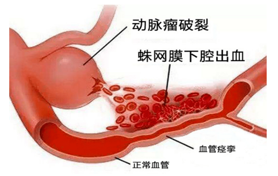 嘶声裂肺的意思 3d5d2e1d84ba48a89c0c2cefeece7a1c.png