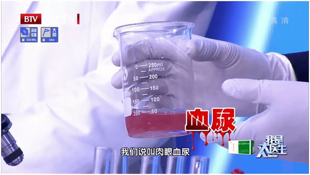 痛风|人体最痛的六种病,痛风仅排第五!希望你一个都没经历过~