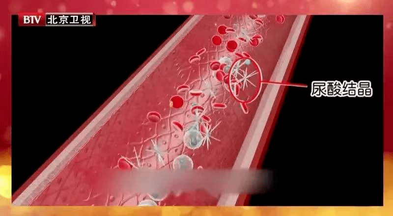 痛风|人体最痛的六种病,痛风仅排第五!希望你一个都没经历过~