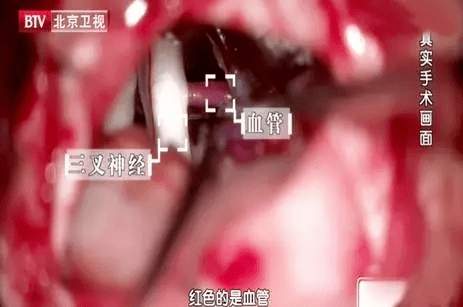 痛风|人体最痛的六种病,痛风仅排第五!希望你一个都没经历过~