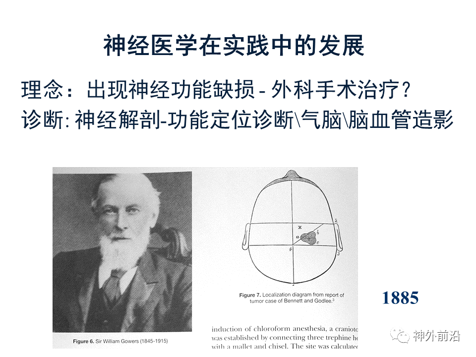 神经|智慧神外 | 天坛医院赵元立：大数据时代的神经医学发展