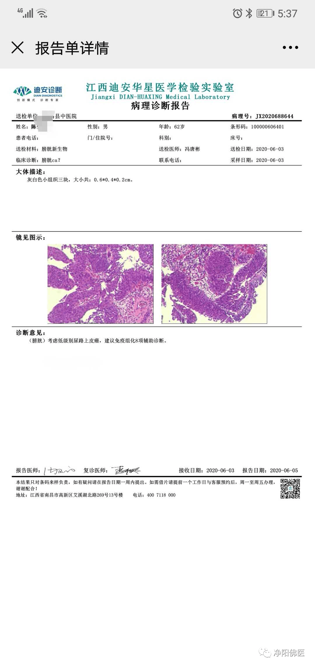 膀胱镜检查提示:膀胱左侧壁癌,左侧输尿管开口约2cm处见菜花状新生物