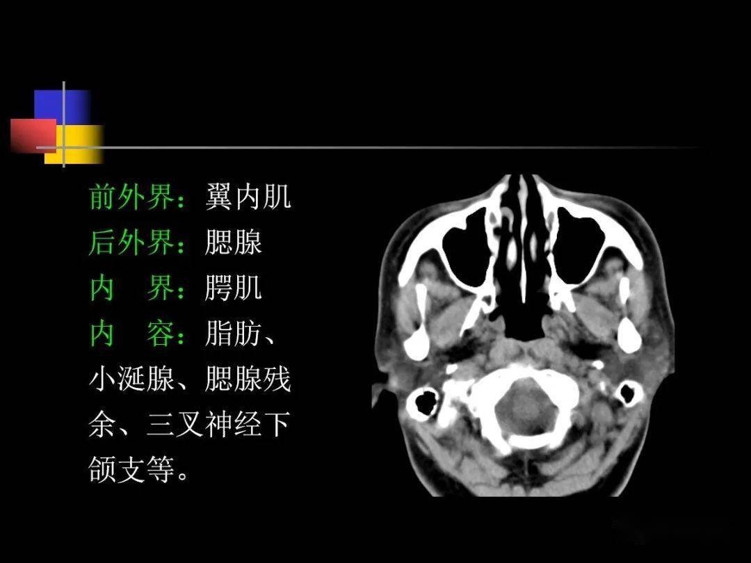 鼻咽部ct解剖