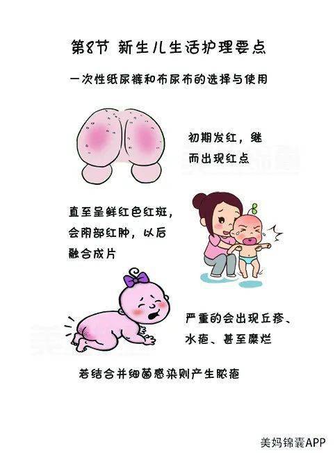 预防婴儿尿布疹的建议