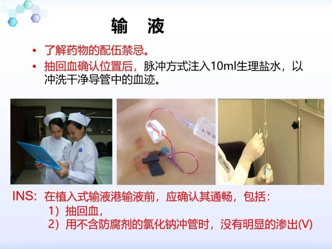 【ppt】输液港的维护和并发症护理