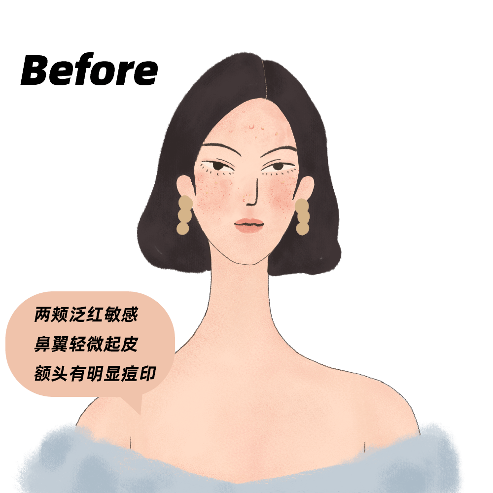 精华|你以为抗老就是祛皱？实际上这点才最重要....