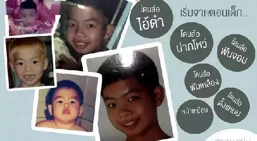 生活|泰国小哥花15万整形，成功从屌丝逆袭变男神！