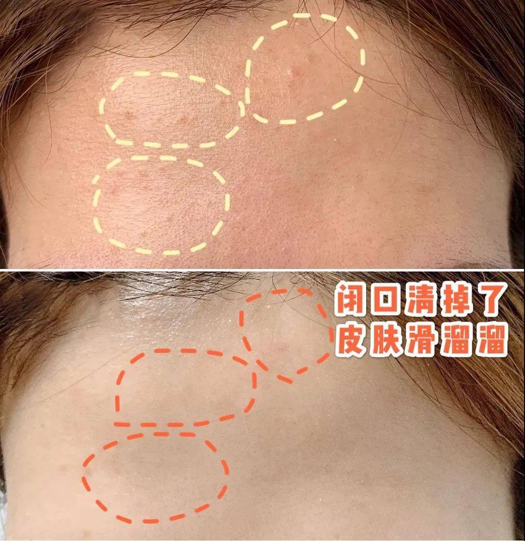 黑头|王霏霏太精明了吧！《浪姐》一播完，立马转行抢主播饭碗了？