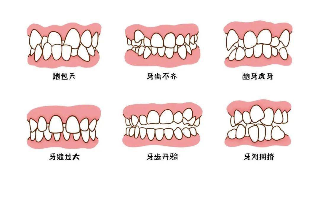 口腔|一起来聊聊这10个关于孩子的口腔问题|七巧板育儿堂