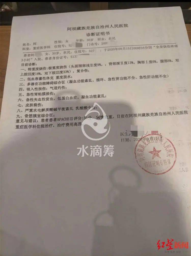 网红女主播直播时,被前夫用汽油烧成重伤!