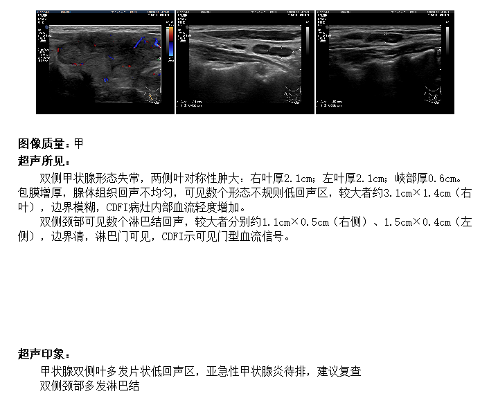 白细胞|误诊率高达70%的疾病，要不要了解一下？