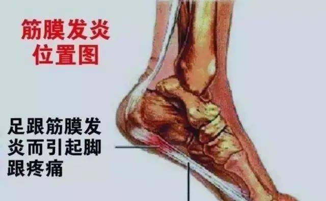 脚底长个包很痛怎么办