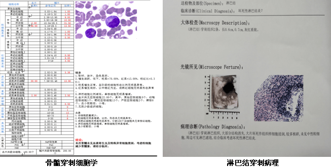 疫情|【抗击疫情 复工复产】反复发烧,可能是得了这种病