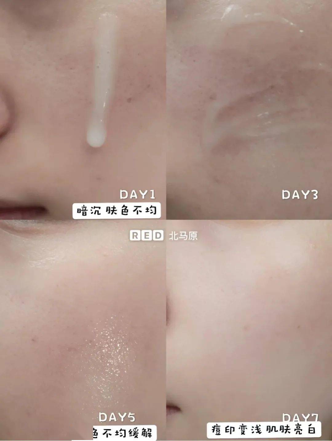 皮肤|翻红女星这都几年没接戏了，还敢这么浪呢？