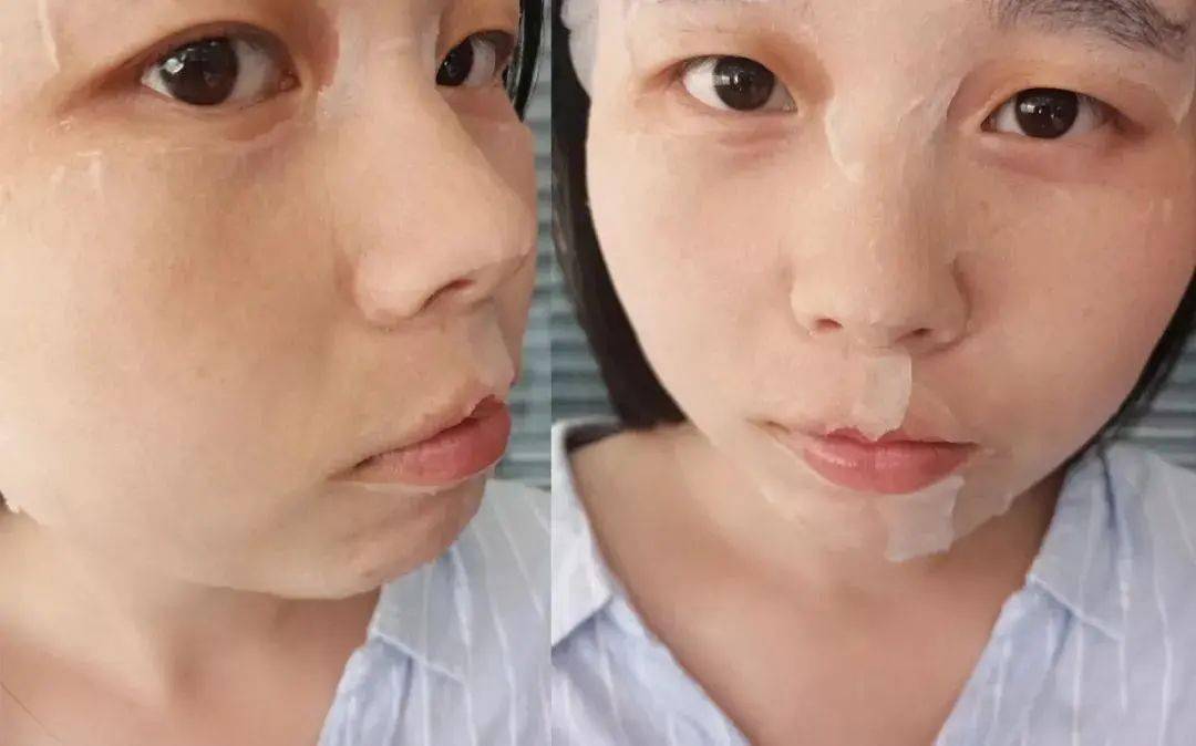 皮肤|刷酸=换脸？这个明星们超爱的百元刷酸好物搞定你的痘痘、闭口、黑头毛孔粗大还不怕烂脸！