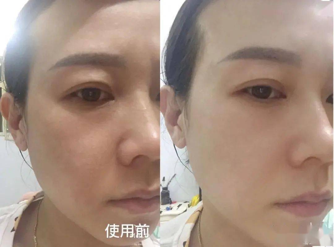 Bug|寻芳记｜换季肤况出Bug？听说比奶茶还甜的她们都用这招！