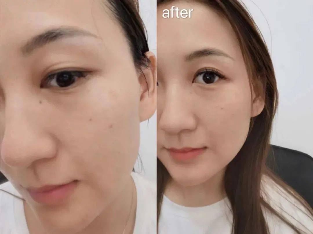 Bug|寻芳记｜换季肤况出Bug？听说比奶茶还甜的她们都用这招！