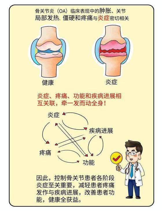 骨关节炎-"炎"从何而来