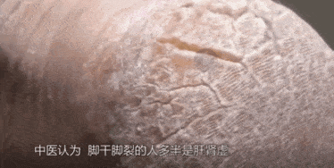 拖鞋|爱穿凉鞋、拖鞋出门的女人,脚上露出这个东西也太丑了吧~