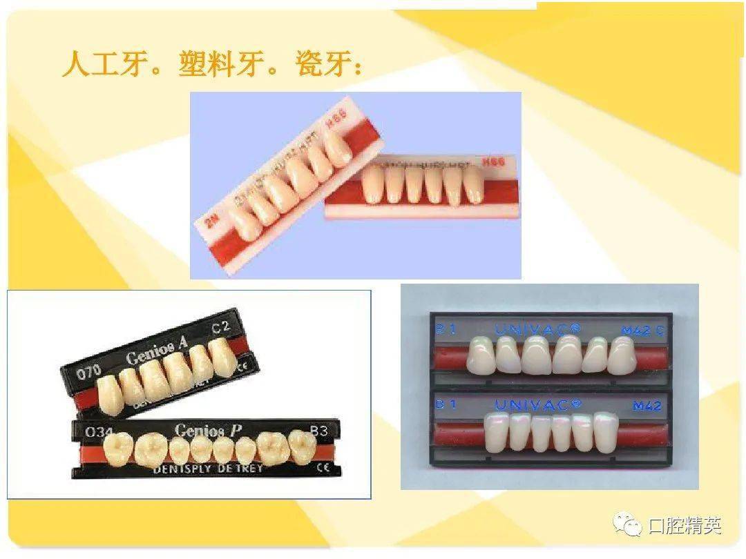 可摘局部义齿-结构