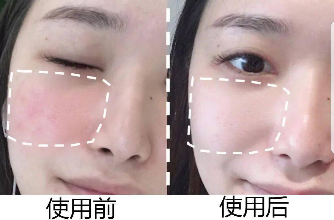 拖鞋|爱穿凉鞋、拖鞋出门的女人,脚上露出这个东西也太丑了吧~