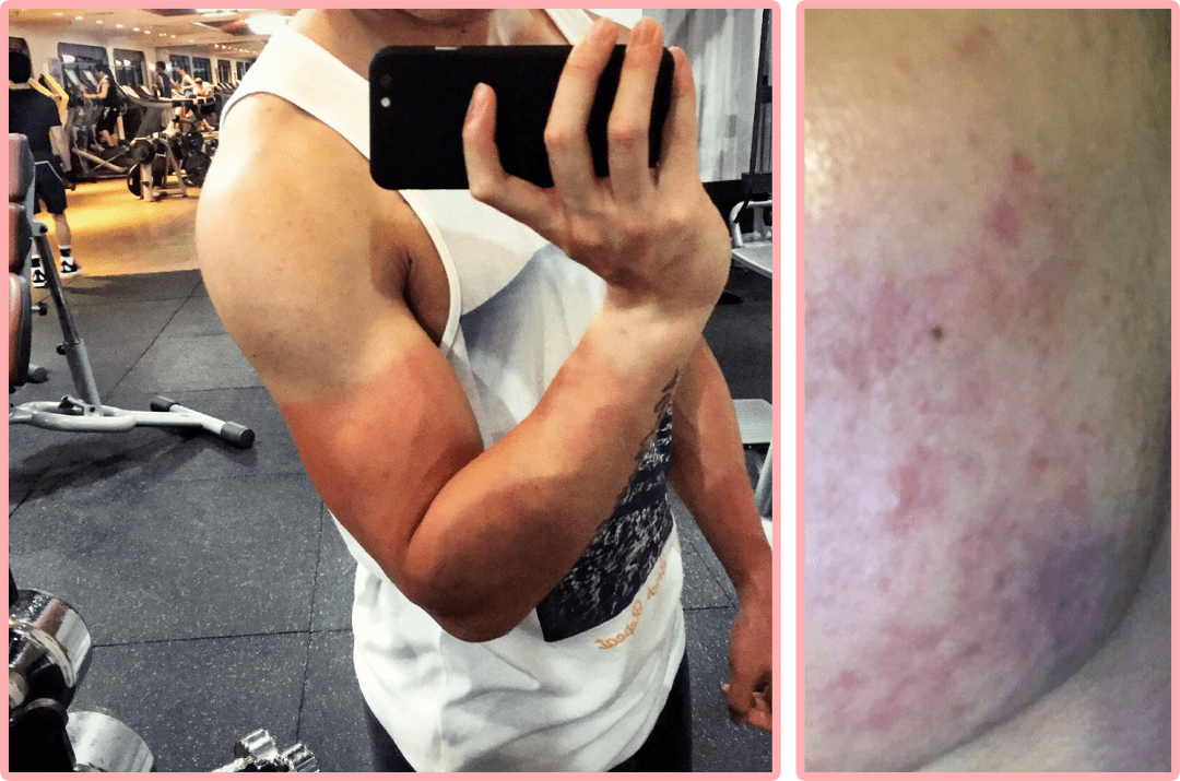 时间|我花3年时间才治好脸，还曾被美容院骗了上万元…