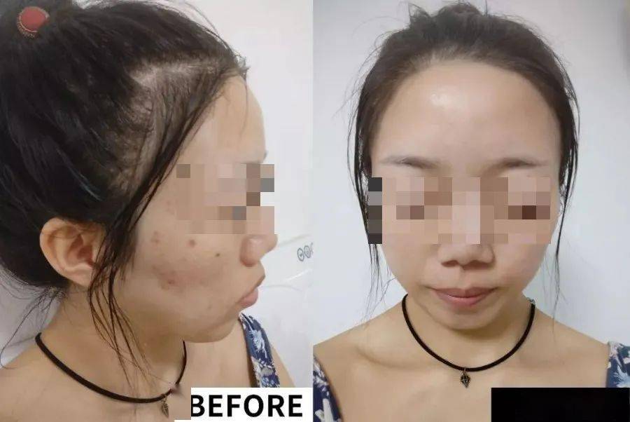 黄帝内经|38岁拿下彭于晏，6分长相却凭素颜艳压全场：懂的人知道，人家年轻的秘密都在这