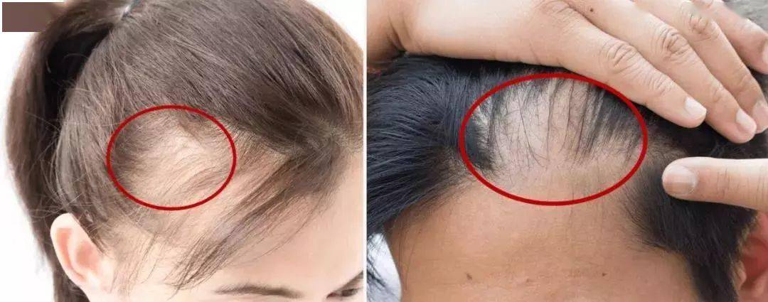 洗头|拯救细软塌,一喷一揉,头发随意蓬!