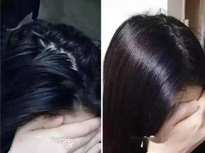 头发|头皮发痒，出油，还掉发？原来是你的洗发水没选好...