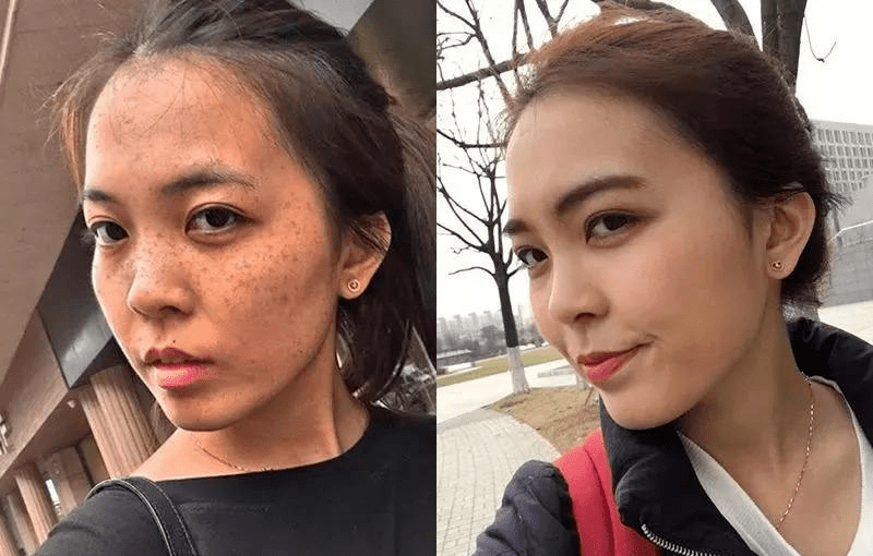 色斑|连抹7天,斑没了,皮肤真的白一度!