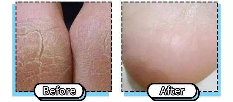 女人|懂得往脸上抹油的女人，还打个P玻尿酸！