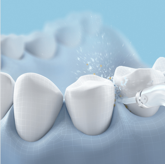 口腔|专业牙医也在用的冲牙器，1秒滋出牙缝残渣，爽！