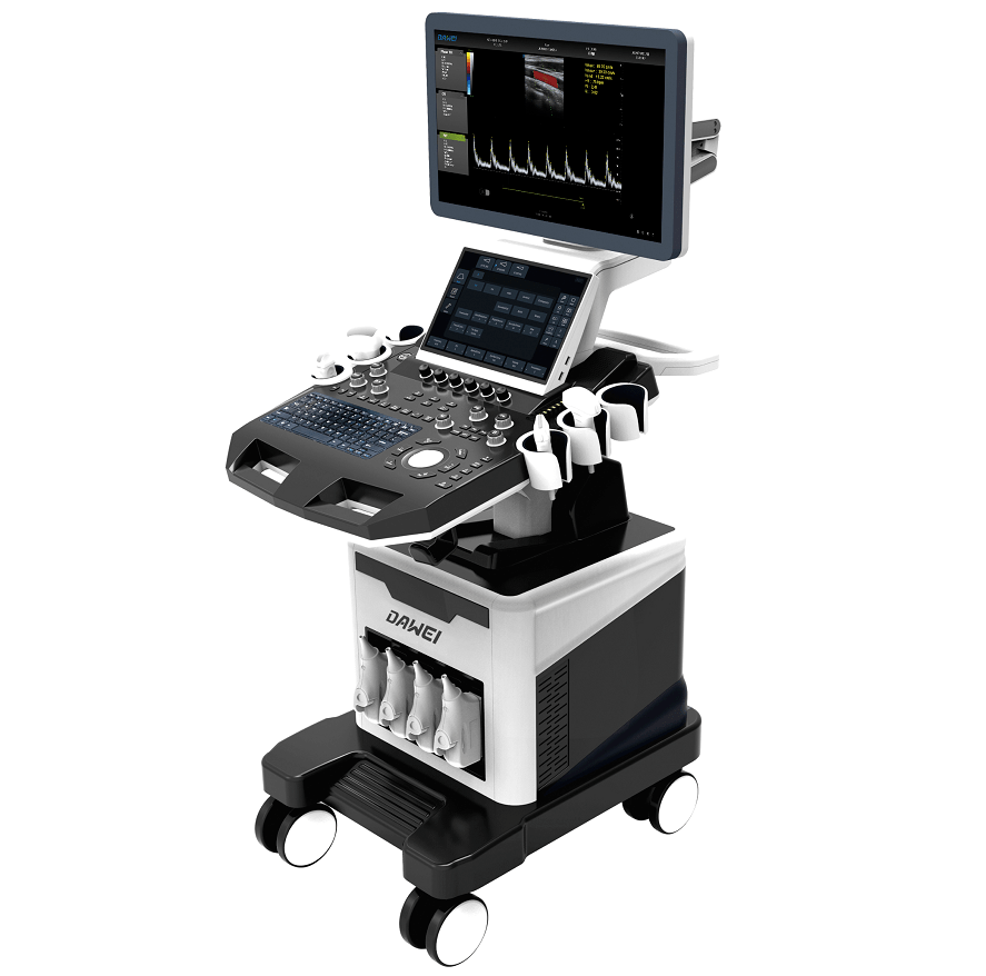 大为 dw-t8 全身应用型高端彩超resona r9是迈瑞昆仑全身应用系列最新