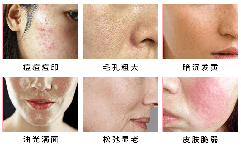 灰色交易|南韩女爱豆“灰色交易”被深扒！18岁出道通吃半个娱乐圈，千亿富豪5次求婚不下嫁：这女的好会玩！