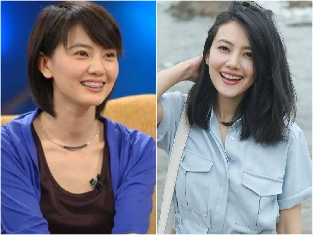 嘴唇|听说80%的人都在为这个颜值bug苦恼