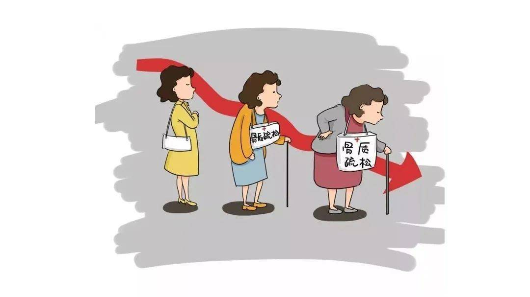 骨质疏松多大年龄开始 78424b91a2bc4464acbd005c6fe17a24.jpeg