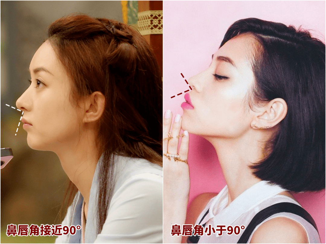 嘴唇|听说80%的人都在为这个颜值bug苦恼