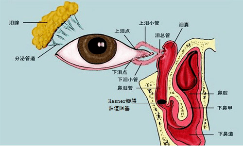 眼睛管堵塞怎么办