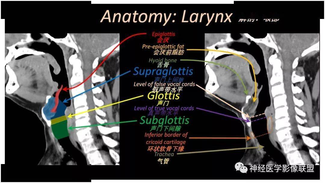 精彩推荐丨内窥镜对照的咽喉部ct解剖