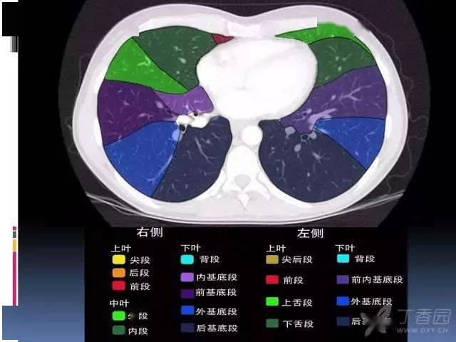 肺叶分段,支气管,肺动脉 ct 图谱全在这--值得收藏