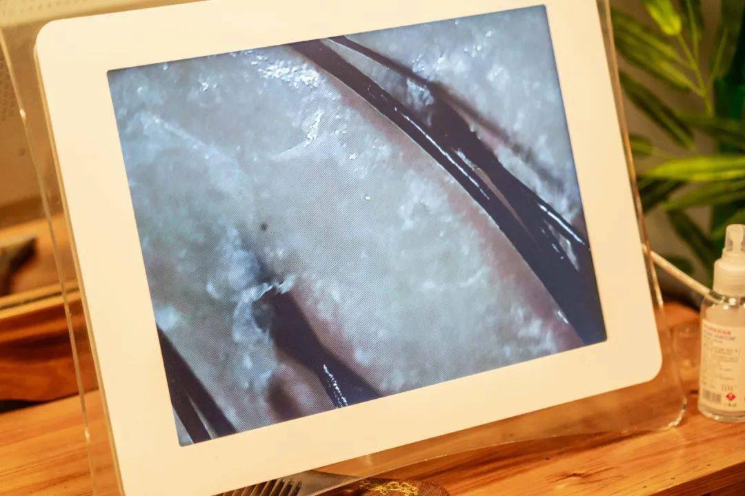 芦荟|薅羊毛啦！59.9元抢芦荟灌肤+滋养水疗+头皮清洁养护！谁做谁赚谁少女！