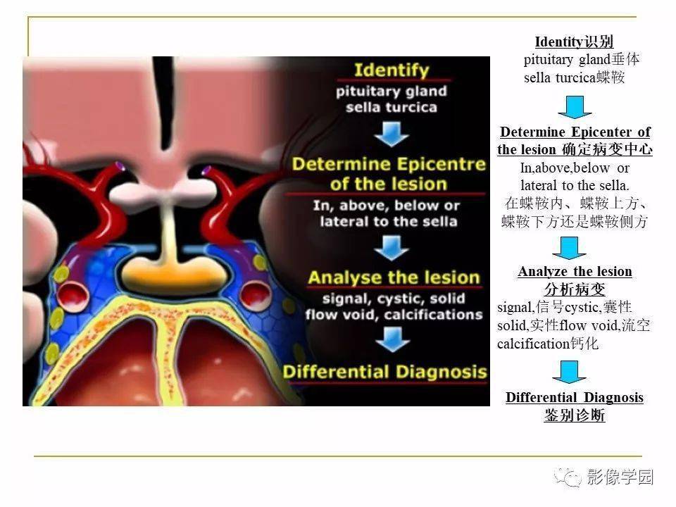 图解蝶鞍及鞍旁区域解剖