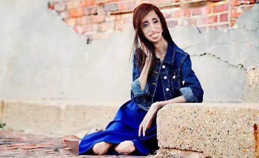 综合征|但却因此只适合出演恐怖片因为基因突变他长成了网文男主的样子