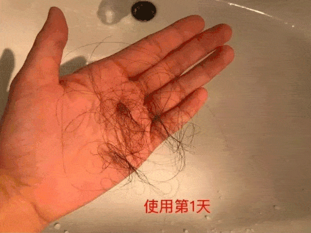 什么|连头发都快拼没了，你拿什么安身立命？