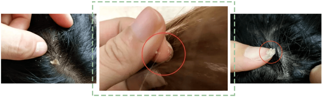 什么|连头发都快拼没了，你拿什么安身立命？