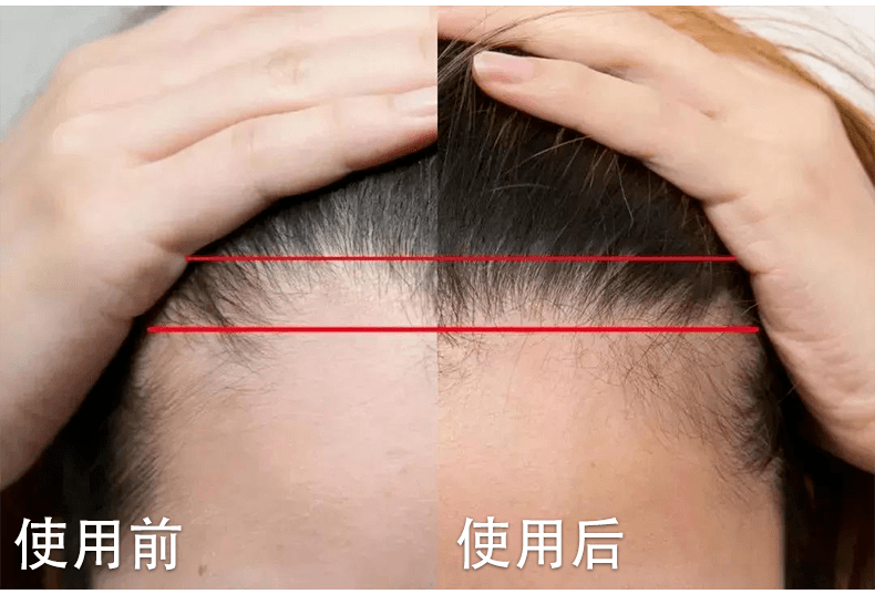 什么|连头发都快拼没了，你拿什么安身立命？