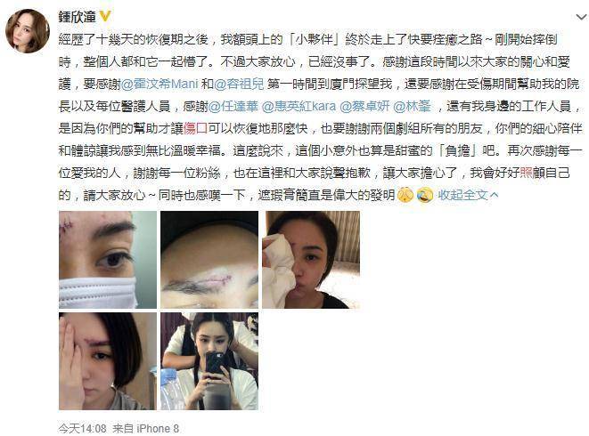 伤疤|阿娇受伤后亮相直播美出新高度，脸上不见伤疤，缝合百针恢复好